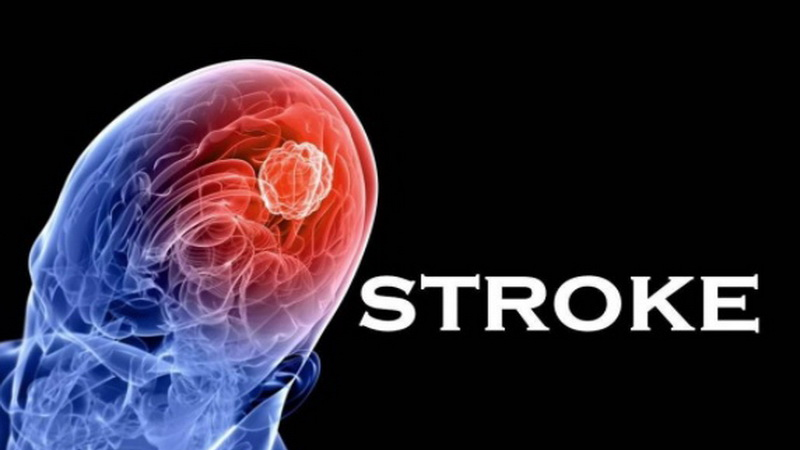 Penyakit Stroke: Kenali Gejala dan Faktor Risikonya